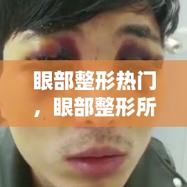 眼部整形熱門，眼部整形所有項目 