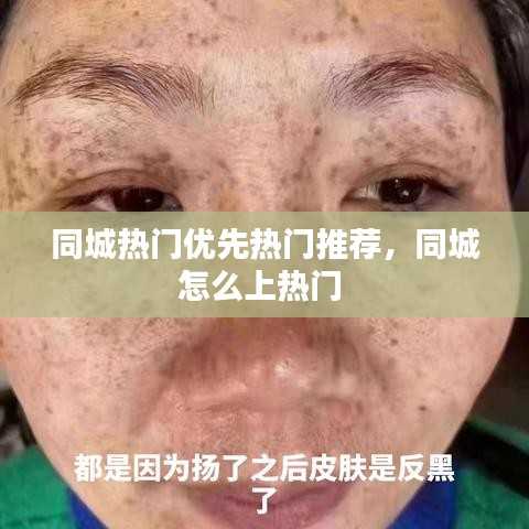 同城熱門優(yōu)先熱門推薦，同城怎么上熱門 