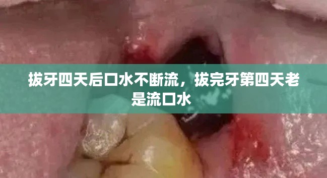 拔牙四天后口水不斷流，拔完牙第四天老是流口水 
