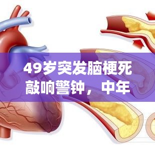 49歲突發(fā)腦梗死敲響警鐘，中年人健康危機不容忽視