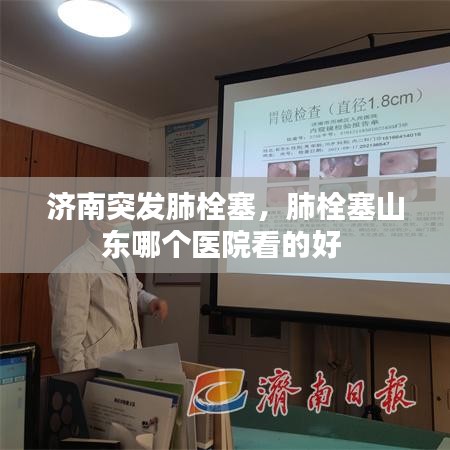 濟南突發(fā)肺栓塞，肺栓塞山東哪個醫(yī)院看的好 