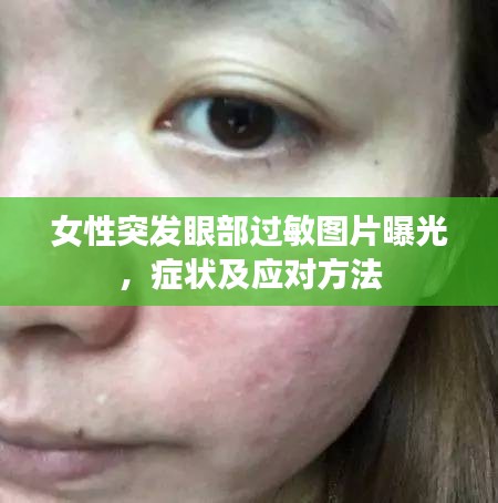 女性突發(fā)眼部過敏圖片曝光，癥狀及應(yīng)對方法