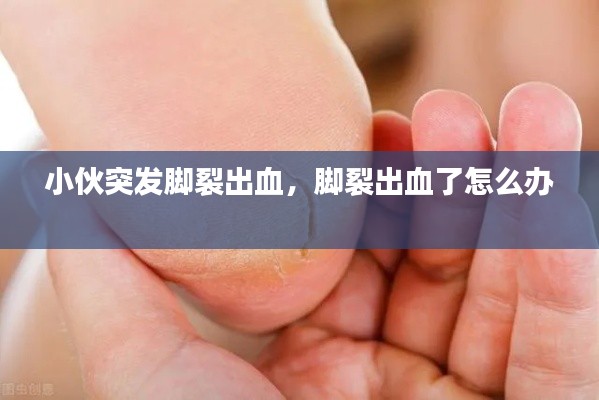 小伙突發(fā)腳裂出血，腳裂出血了怎么辦 