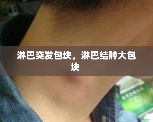 淋巴突發(fā)包塊，淋巴結(jié)腫大包塊 