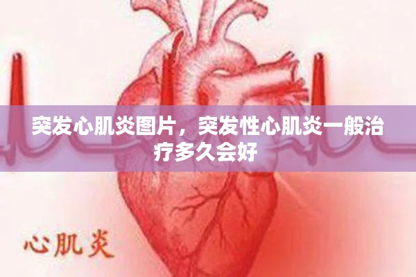 突發(fā)心肌炎圖片，突發(fā)性心肌炎一般治療多久會好 