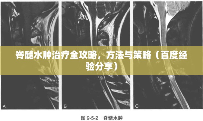 脊髓水腫治療全攻略，方法與策略（百度經(jīng)驗分享）