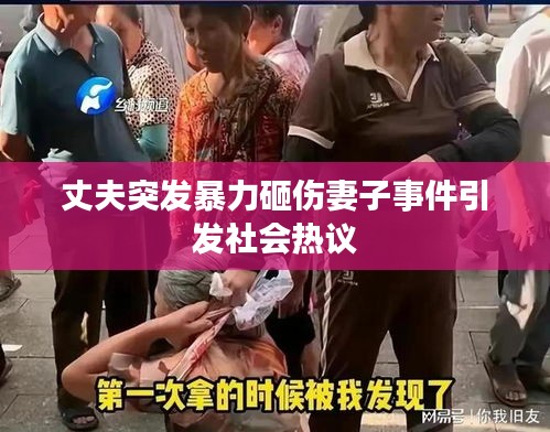 丈夫突發(fā)暴力砸傷妻子事件引發(fā)社會熱議