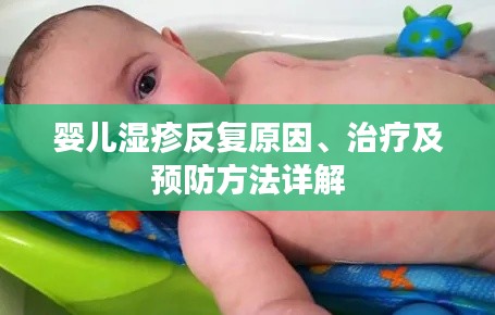 嬰兒濕疹反復(fù)原因、治療及預(yù)防方法詳解
