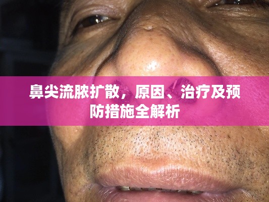 鼻尖流膿擴(kuò)散，原因、治療及預(yù)防措施全解析