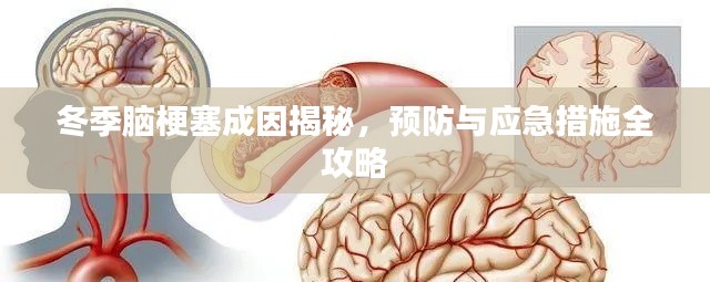 冬季腦梗塞成因揭秘，預(yù)防與應(yīng)急措施全攻略