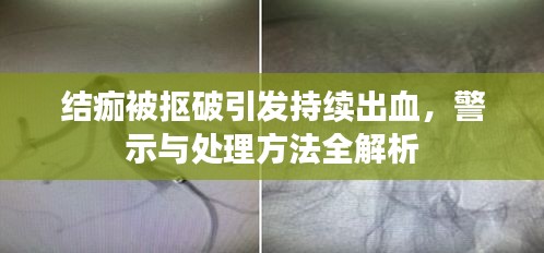 結痂被摳破引發(fā)持續(xù)出血，警示與處理方法全解析