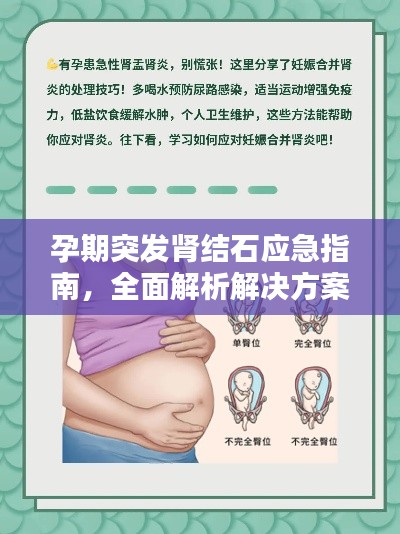 孕期突發(fā)腎結(jié)石應(yīng)急指南，全面解析解決方案
